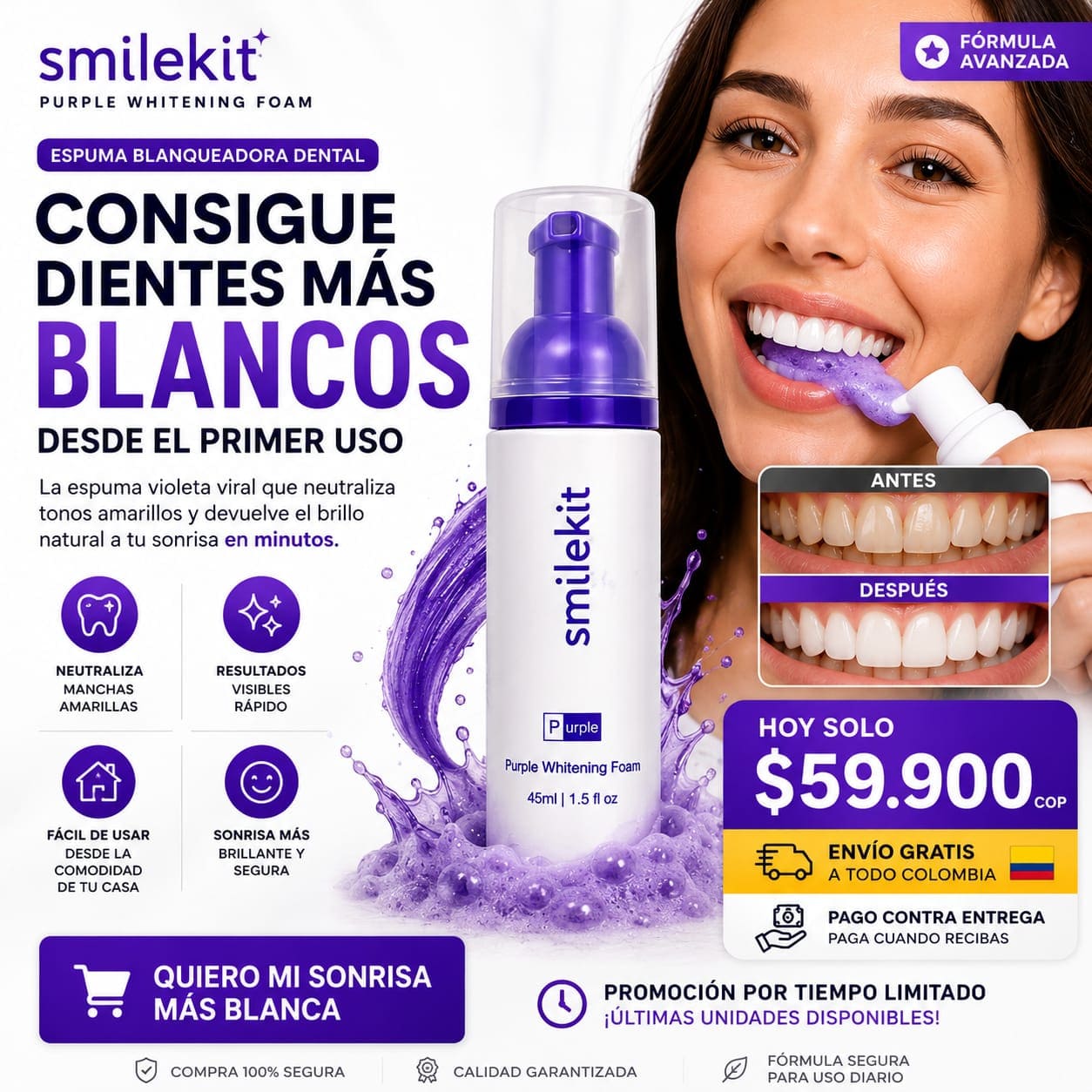 💎Smilekit V34: La Corrección Violeta Para Una Sonrisa Más Brillante💎